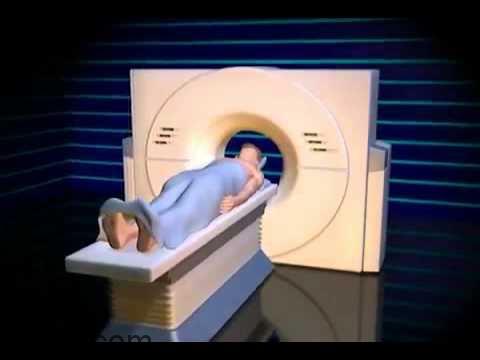 CT Scan