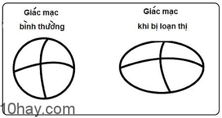 Loạn thị