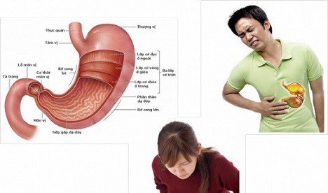 Bệnh loét dạ dày tá tràng