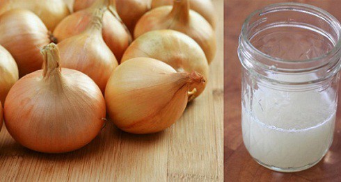 Trị rụng tóc bằng nước ép hành tây