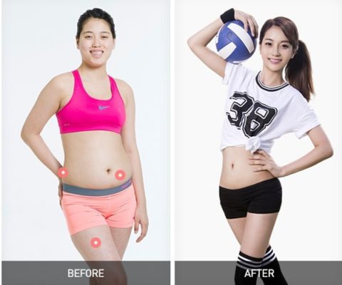 Cuộc sống hoàn toàn thay đổi của cô gái Hàn Quốc sau phẫu thuật