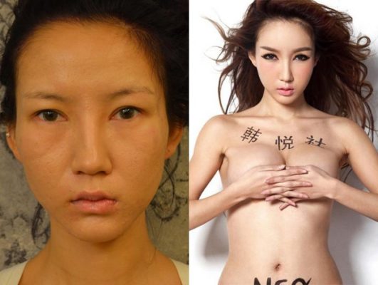 Người mẫu Trung Quốc tràn đầy tự tin sau phẫu thuật thẩm mỹ