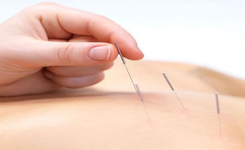 cách chữa bệnh đau lưng hiệu quả cách chữa bệnh đau lưng hiệu quả